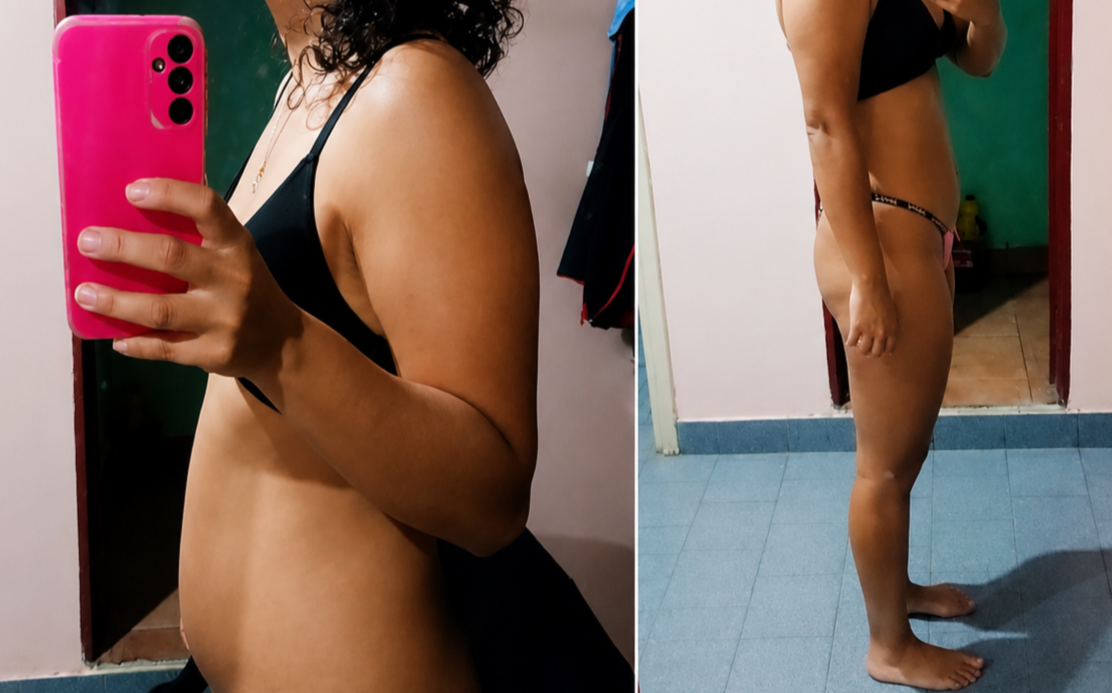 Hidroterapia Colónica